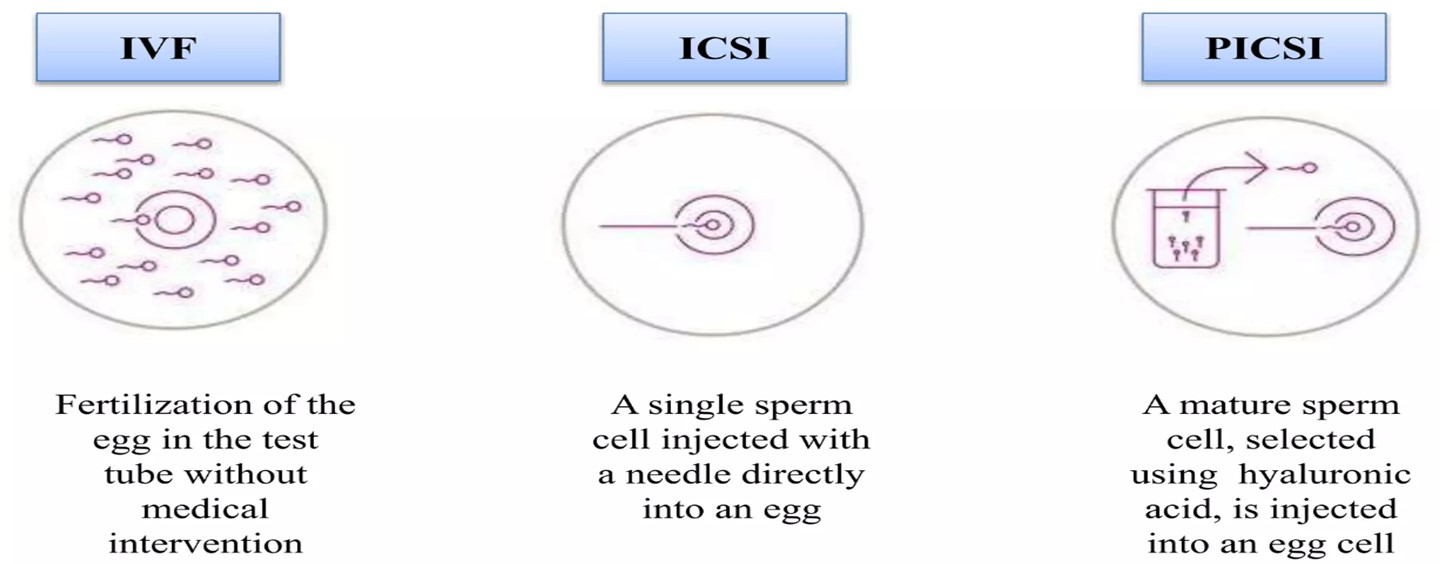 Picsi Physiological Intracytoplasmic Sperm Injection Esco Medical