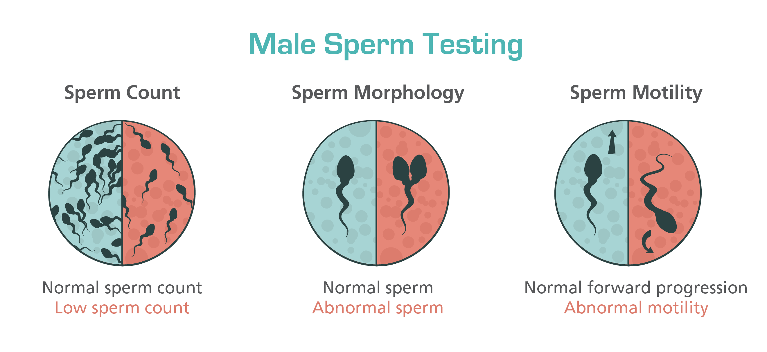 Male Factor In Infertility Among Couples Esco Medical